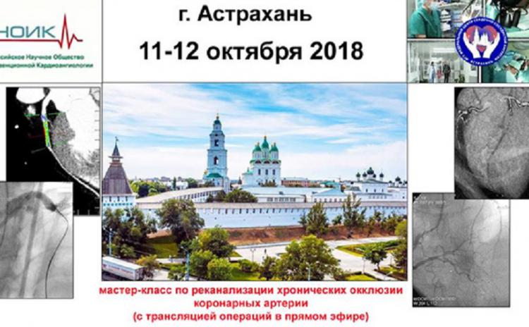ПроКардио приняла участие в мастер-классе по реканализации хронических окклюзий коронарных артерий ПроКардио представила в Астрахани новые разработки от компаний “Asahi Intecc” и “Vascular Solutions"